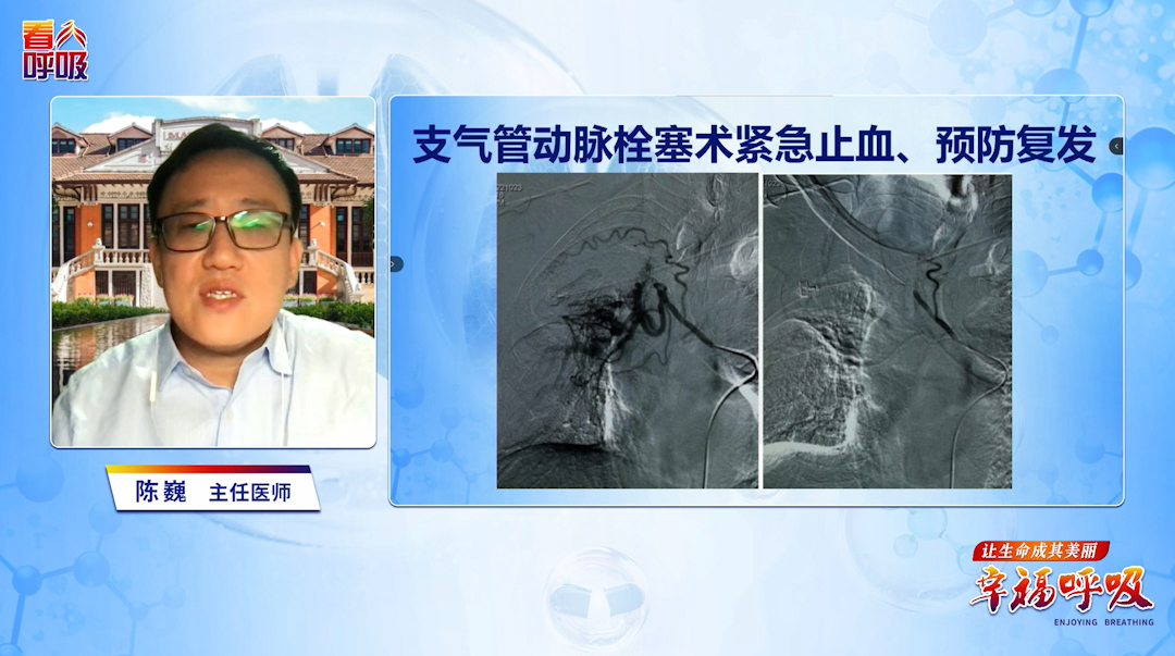 干性VS湿性，支扩如何分型而治？