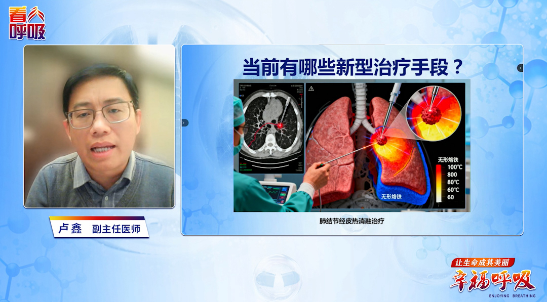 什么新型手段可以不用开刀根治肺癌？