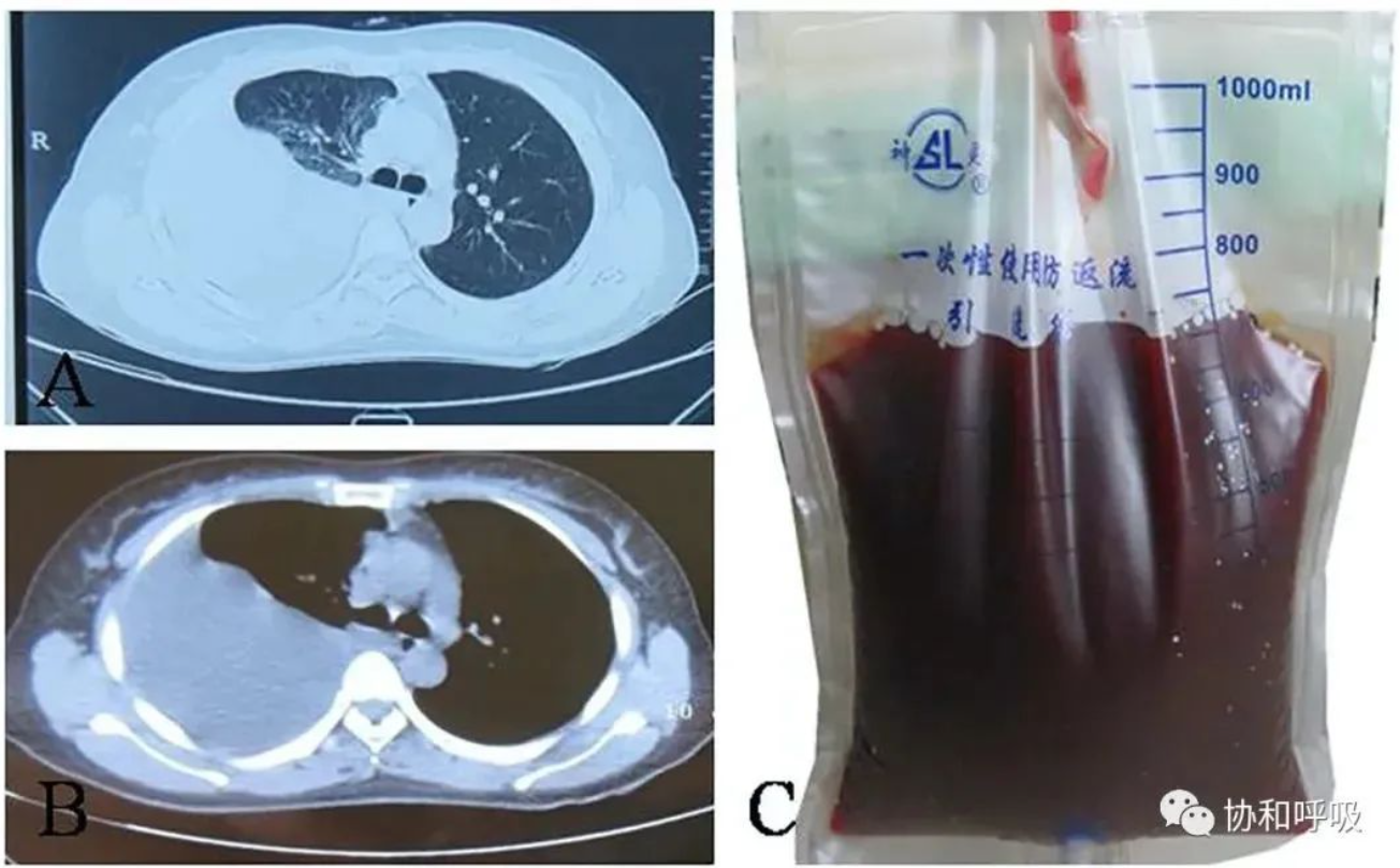 見通しはどうですか?
