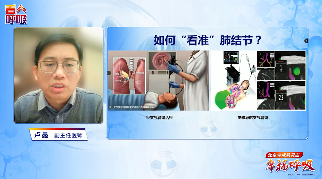 肺穿刺活检怎么做、谁需做？