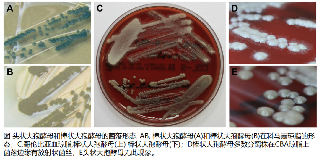 体のさまざまな領域の感染症