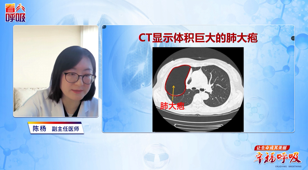 哪种肺大疱一定要尽快切掉？