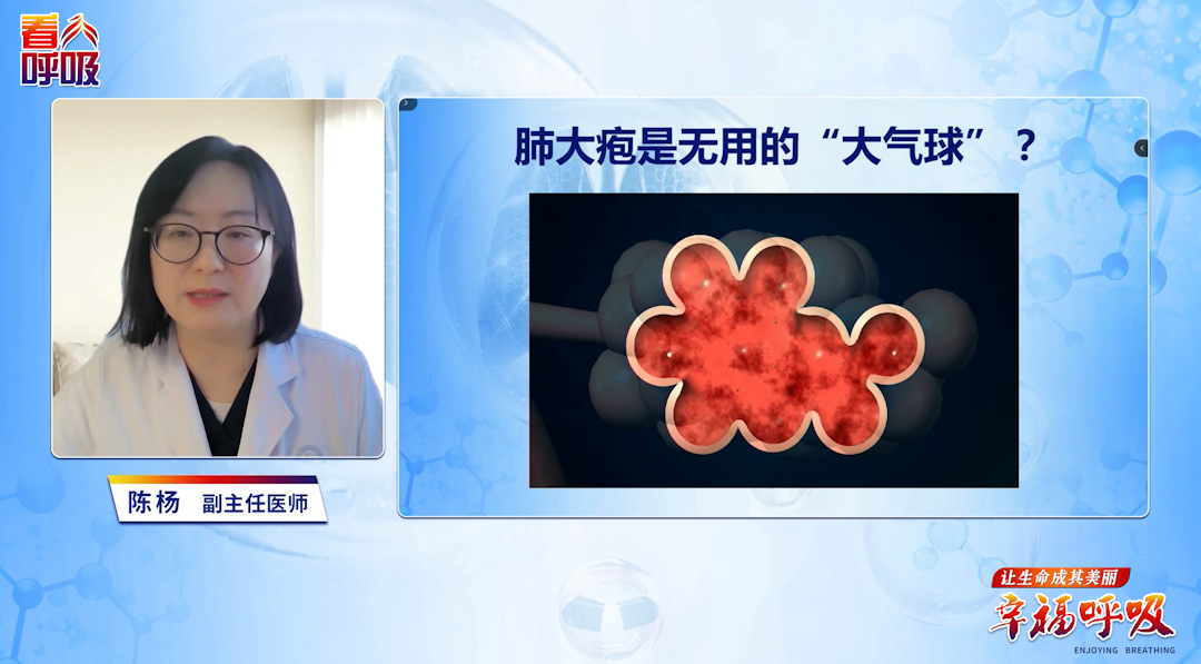 肺大疱堪比肺内无效“大气球”？